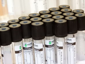 科技期刊,科学进步的催化剂 第1张 科技期刊,科学进步的催化剂 第1张